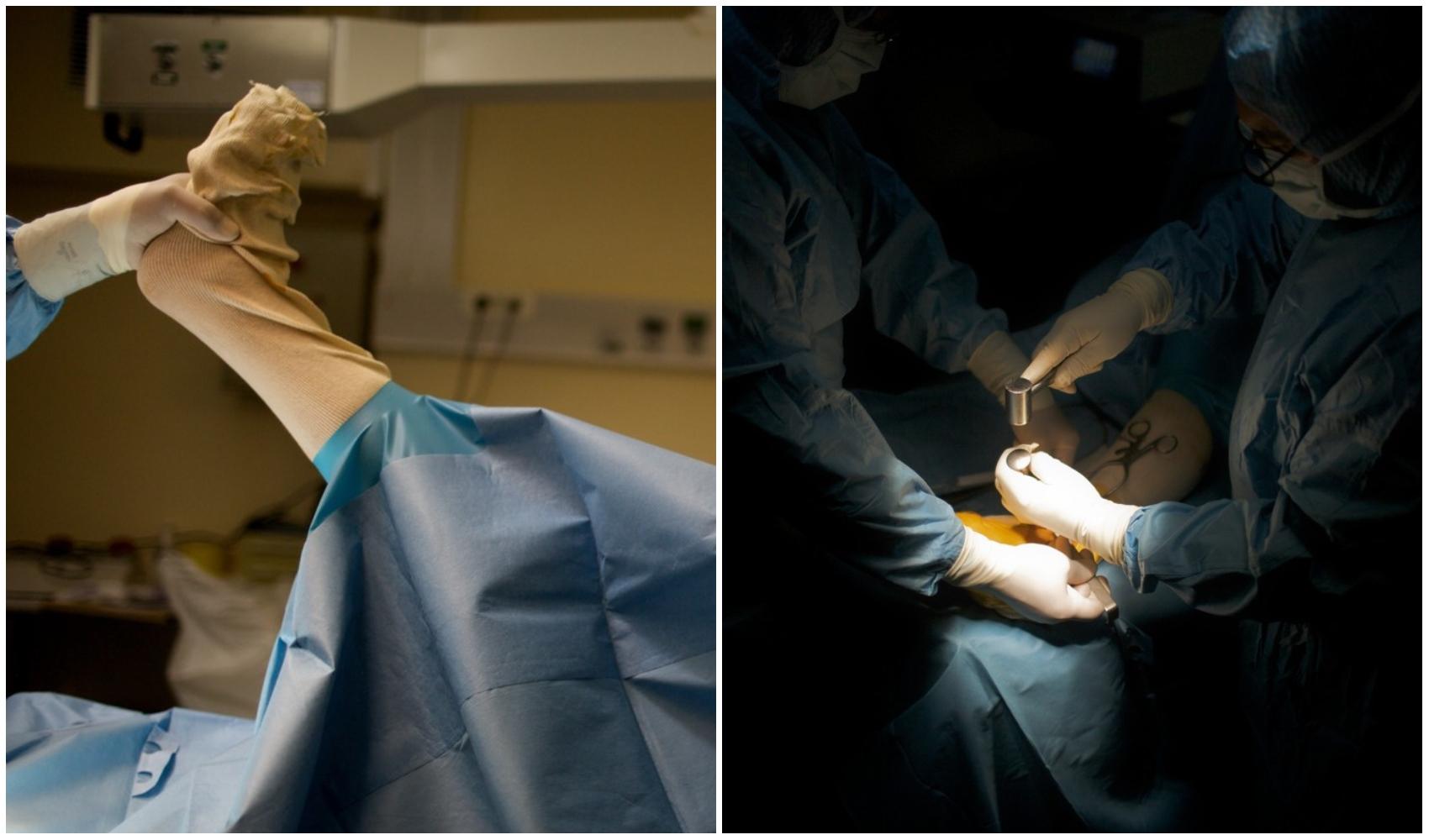 doua imagini din timpul unei operatii la picior