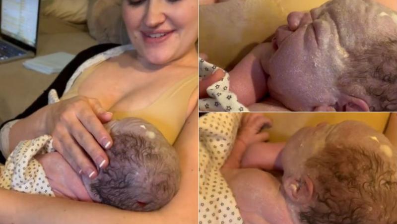 colaj de imagini cu un bebelus care are pelicula alba pe piele