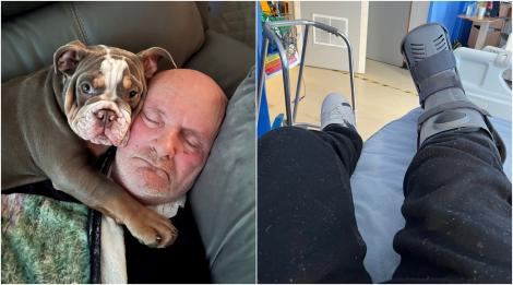 Câinele său i-a ronțăit degetul până la os, în timp ce dormea, dar asta i-a salvat viața. Ce a observat când s-a trezit