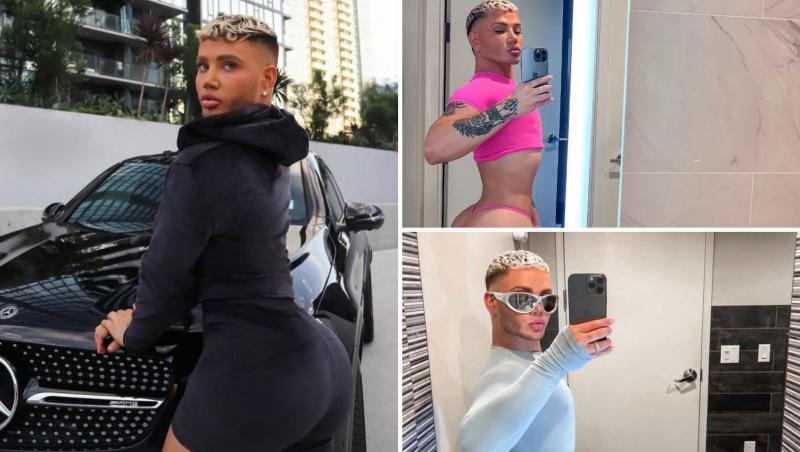 Un bărbat de 27 de ani a recurs la o mulțime de operații estetice costisitoare pentru a avea fața păpușei Ken și corpul lui Kim Kardashian. Care e suma de bani pe care a scos-o din buzunar.