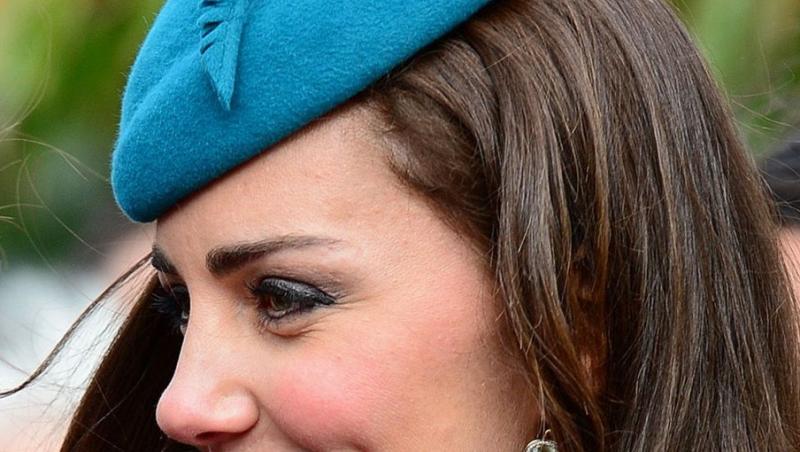 Cicatricea secretă pe care Kate Middleton o ascunde cu măiestrie. Este în plină vedere, dar nu ai observat-o până acum