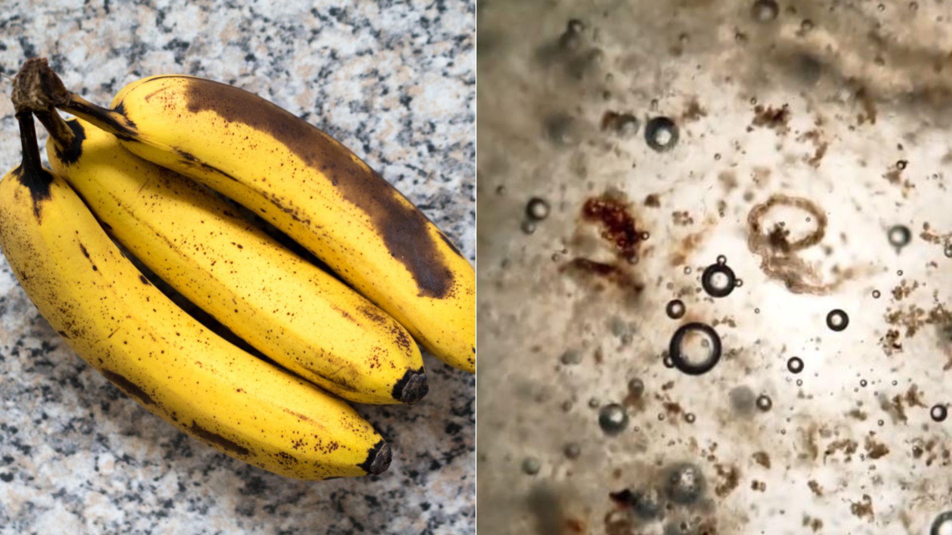 colaj de imagini cu o banana coapta intr-o parte si o captura cu ce contine vazuta la microscop
