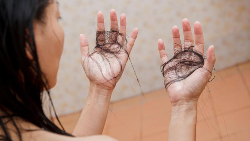 Cazul neobișnuit al unei femei dependente să-și mănânce propriul păr. Ce i-au găsit medicii în stomac i-a lăsat fără cuvinte