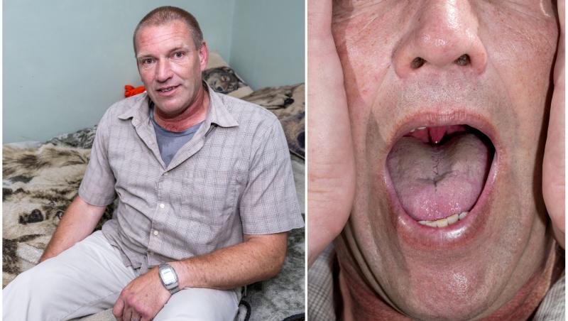 Bărbatul a inhalat un păianjen în timpul somnului și a ajuns de urgență la spital