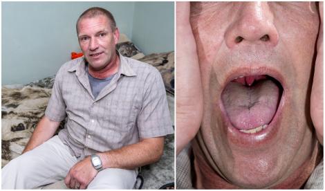 Un bărbat a înghițit din greșeală un păianjen în timpul somnului și insecta l-a mușcat de gât. Ce a urmat