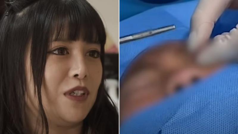 O femeie din Japonia și-a îndemnat fiica, în vârstă de 9 ani, să își facă o operație pentru a arăta ”frumoasă”.