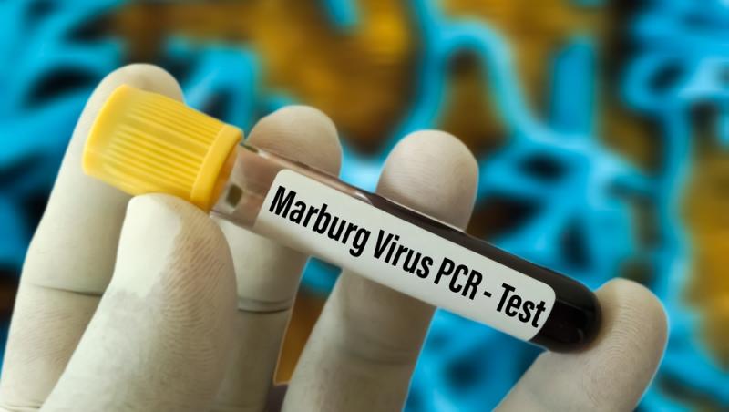 Virusul Marburg a dus la apariția unei noi epidemii. Care sunt simptomele și unde se răspândește