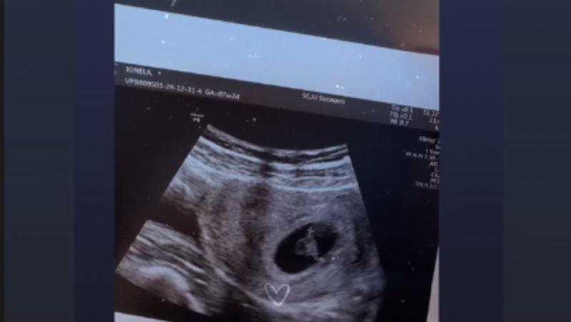 Mireasa, sezon 10. Ionela a fost la prima ecografie. Ea și Robert au ascultat bătăile inimii bebelușului din burtică
