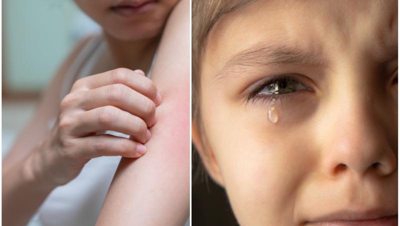 Copila este alergică la lacrimi și sudoare și nu există un tratament ce îi poate aduce vindecarea