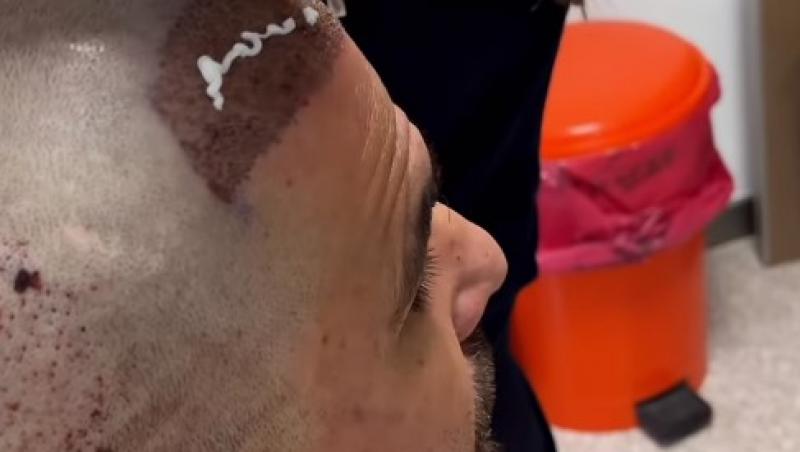 Primele imagini cu Adrian Mutu după ce și-a făcut implant de păr. Cum arată antrenorul | GALERIE FOTO