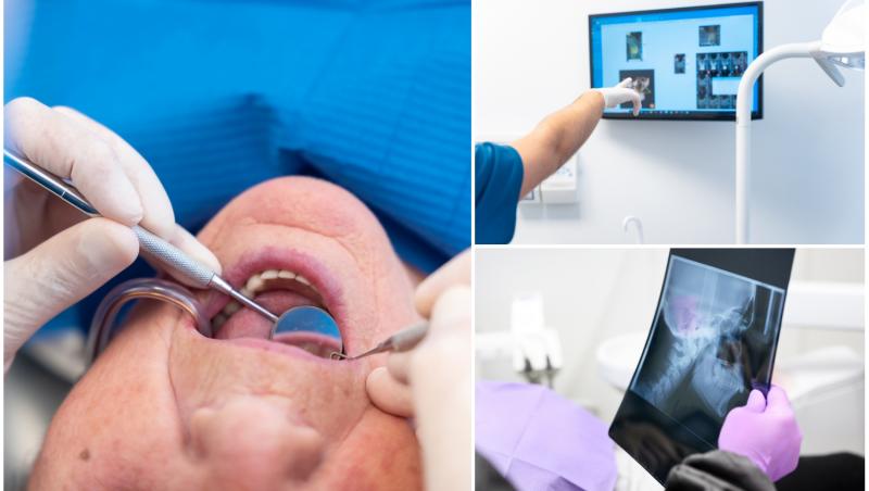 După implantul de dinți, bărbatul a fost nevoit să treacă printr-o operație periculoasă