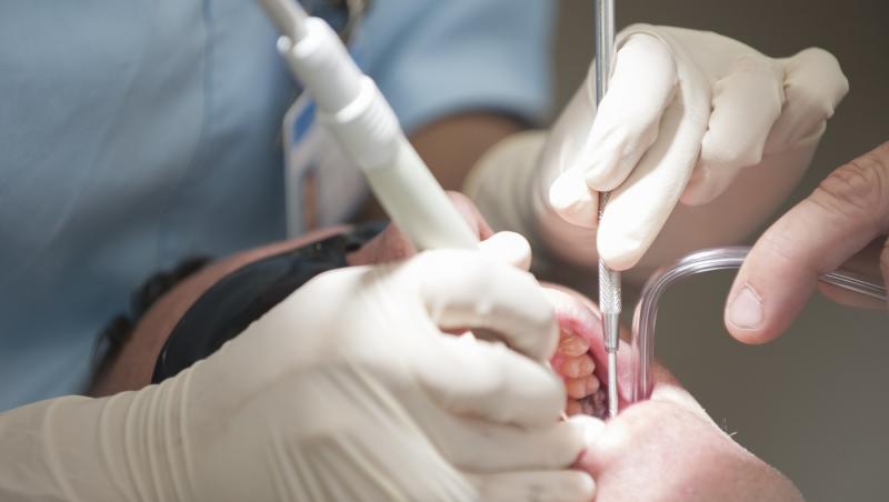 Un bărbat și-a făcut implant de dinți. Când a ajuns la spital, medicii au rămas mască atunci când au văzut ce are omul în cap