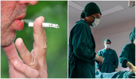 Un fumător care avea o tuse puternică a mers la spital și medicii au rămas mască atunci când au văzut ce crește în gâtul omului