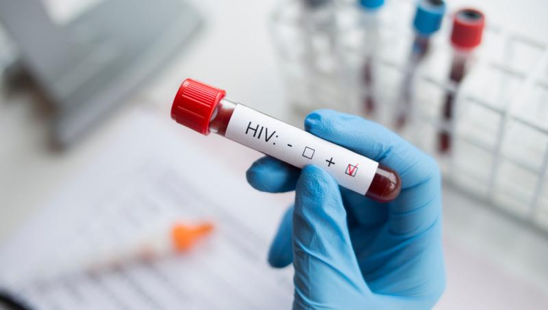 Un nou caz vindecat de HIV. Este al șaptelea pacient care nu mai este infectat de virus