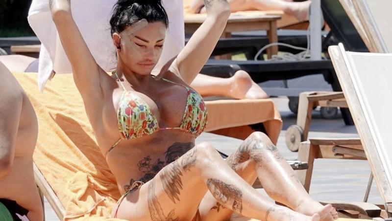 Katie Price a apărut la piscină cu bandaje pe față, imediat după o vizită la medicul estetician. Ce au observat cei prezenți