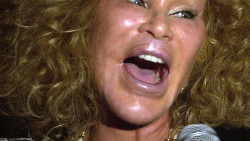 Femeia supranumită Catwoman a decedat. Jocelyn Wildenstein era cunoscută pentru operațiile estetice. Care a fost cauza decesului