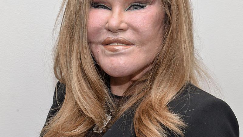 Femeia supranumită Catwoman a decedat. Jocelyn Wildenstein era cunoscută pentru operațiile estetice. Care a fost cauza decesului