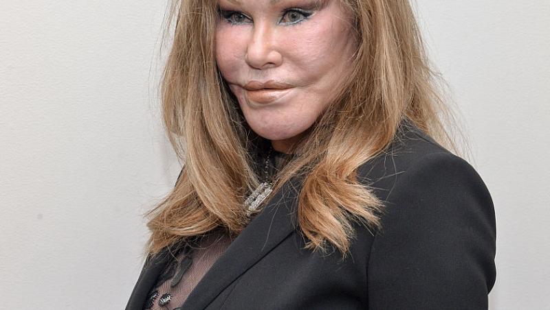 Femeia supranumită Catwoman a decedat. Jocelyn Wildenstein era cunoscută pentru operațiile estetice. Care a fost cauza decesului