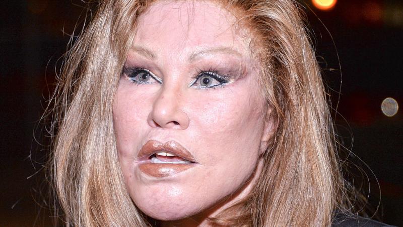 Femeia supranumită Catwoman a decedat. Jocelyn Wildenstein era cunoscută pentru operațiile estetice. Care a fost cauza decesului