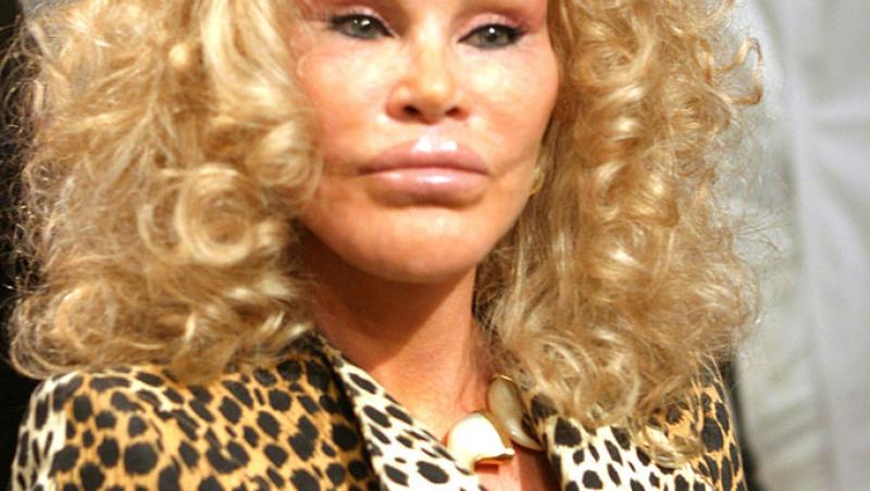 Femeia supranumită Catwoman a decedat. Jocelyn Wildenstein era cunoscută pentru operațiile estetice. Care a fost cauza decesului