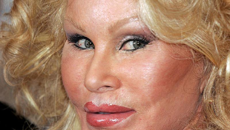 Femeia supranumită Catwoman a decedat. Jocelyn Wildenstein era cunoscută pentru operațiile estetice. Care a fost cauza decesului