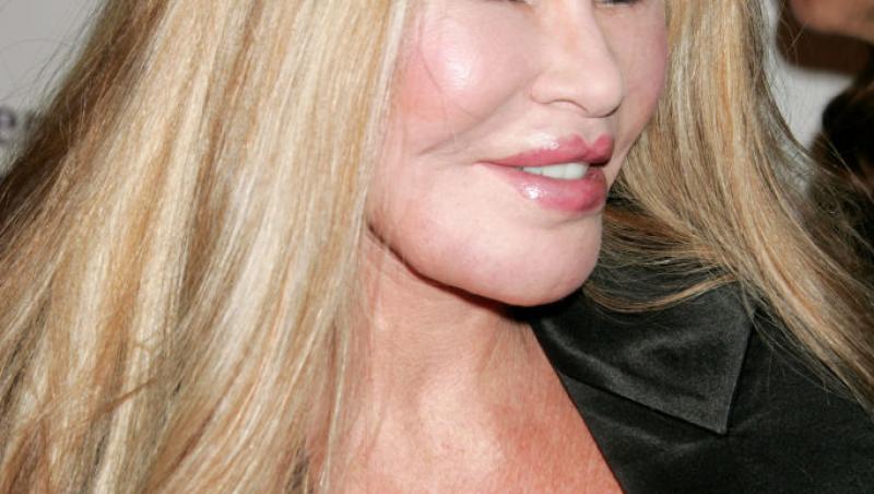 Femeia supranumită Catwoman a decedat. Jocelyn Wildenstein era cunoscută pentru operațiile estetice. Care a fost cauza decesului