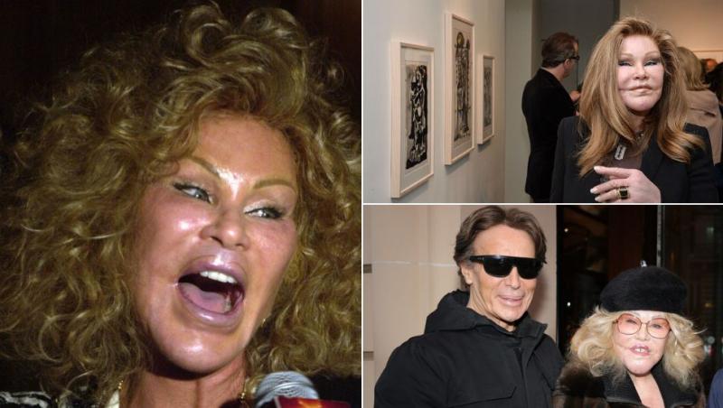 colaj Jocelyn Wildenstein și Jocelyn Wildenstein împreună cu Lloyd Klein, partenerul său