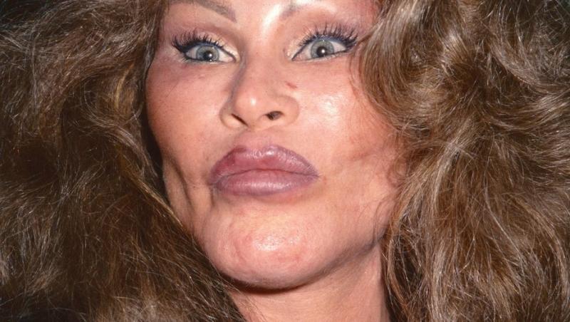 Femeia supranumită Catwoman a decedat. Jocelyn Wildenstein era cunoscută pentru operațiile estetice. Care a fost cauza decesului