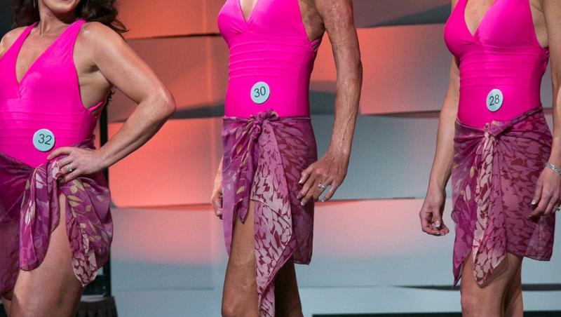 A renăscut din propria cenușă. Cum arată  acum femeia care a devenit Miss, după ce a suferit arsuri de gradul 3 pe 70% din corp