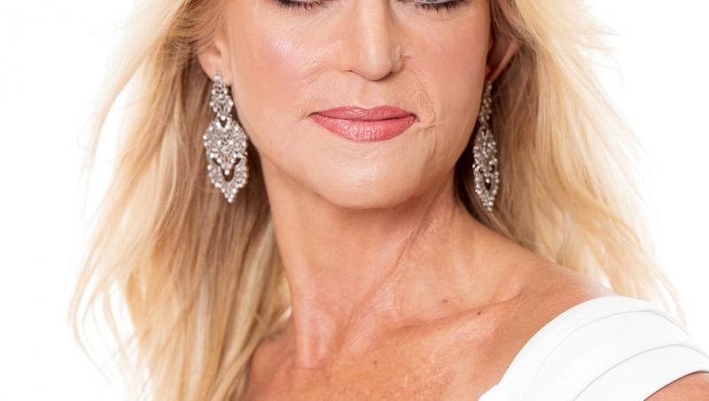 A renăscut din propria cenușă. Cum arată  acum femeia care a devenit Miss, după ce a suferit arsuri de gradul 3 pe 70% din corp