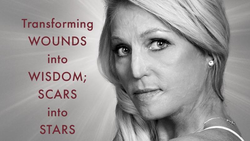 A renăscut din propria cenușă. Cum arată  acum femeia care a devenit Miss, după ce a suferit arsuri de gradul 3 pe 70% din corp