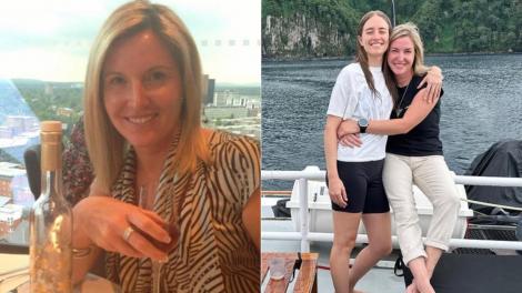 Femeia și-a dorit un lifting facial, dar a rămas cu găuri adânci în piele după intervenție. Ce s-a întâmplat