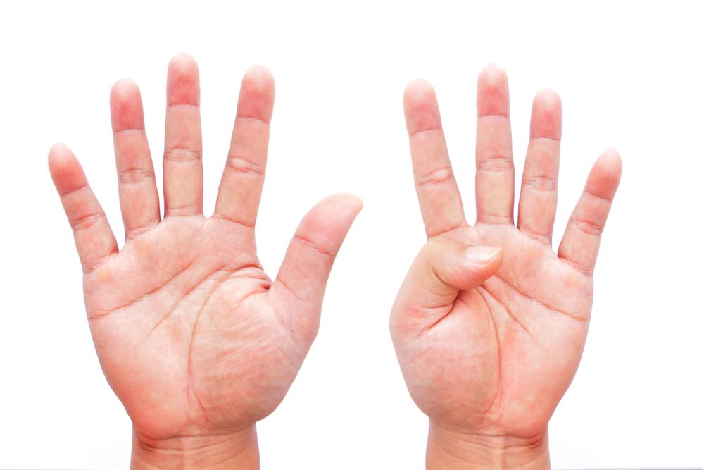 două palme cu degetele întinse și una cu degetul mare flexat peste palmă
