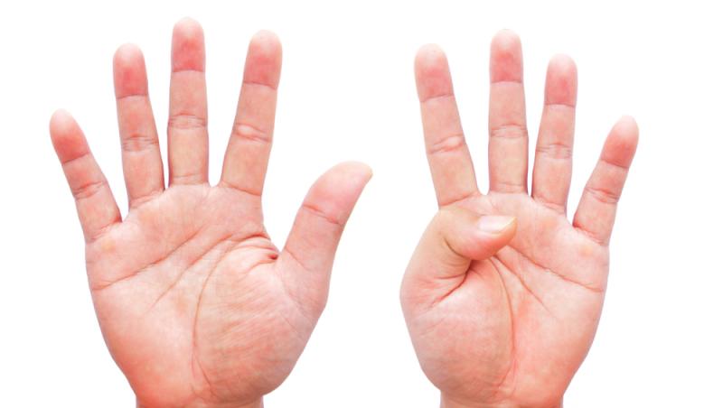 două palme cu degetele întinse și una cu degetul mare flexat peste palmă