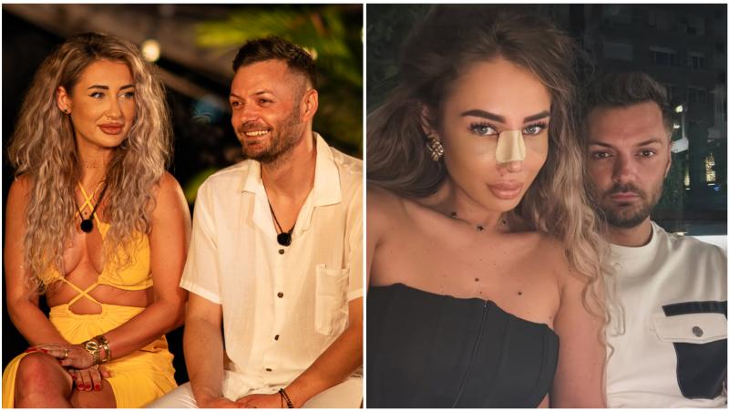 Maria Avram și-a făcut rinoplastie