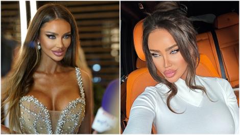 De ce își dizolvă Bianca Drăgușanu acidul din buze. Răspunsul vedetei i-a uimit pe fani: „Sunt pe drumul cel bun”