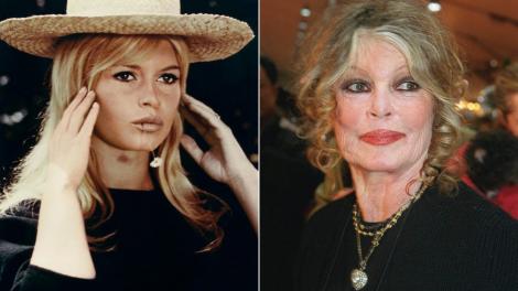 Brigitte Bardot se confruntă cu o boală gravă. Ce spun medicii despre recuperarea celebrei actrițe