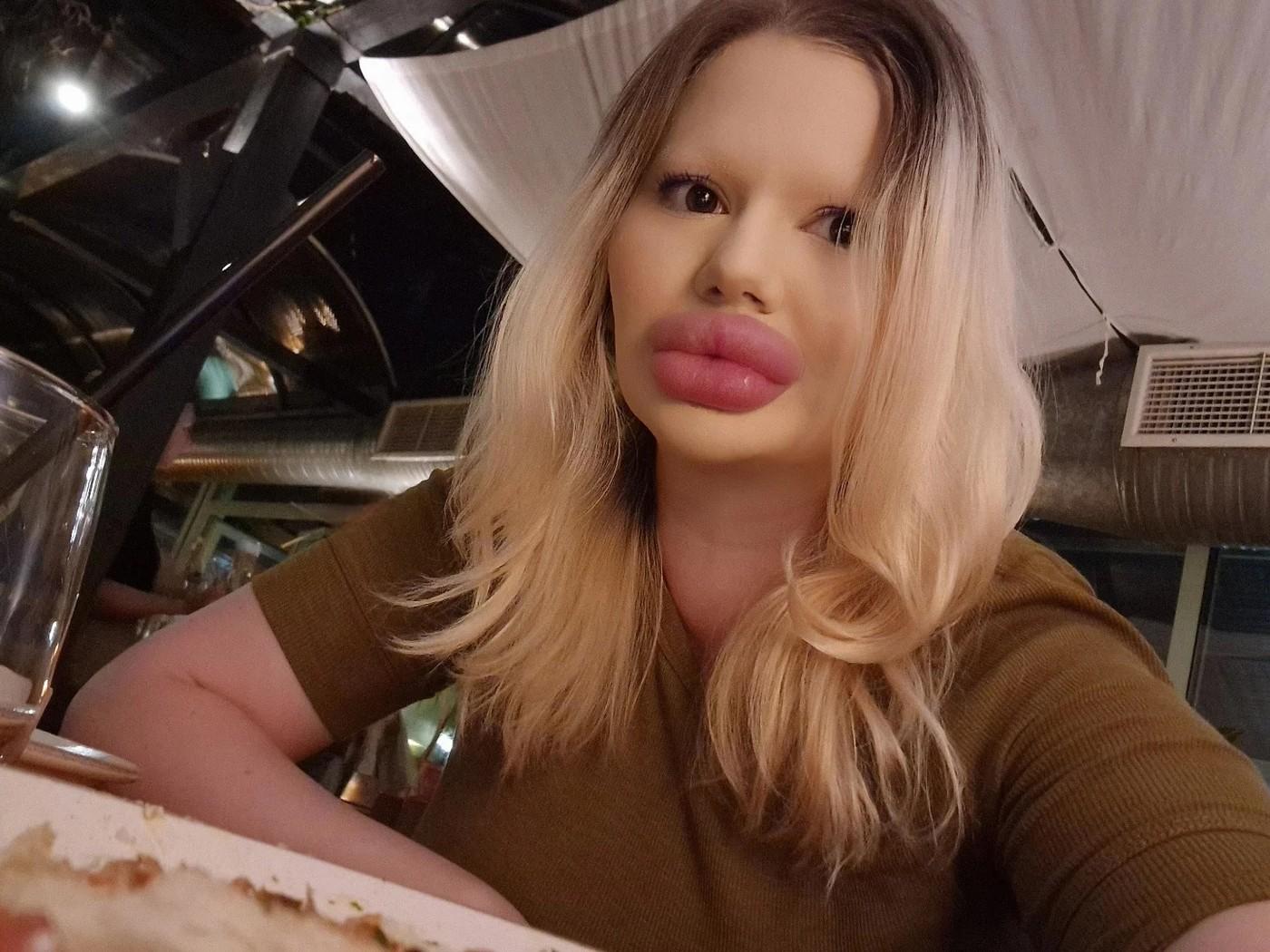 Andrea Ivanova, femeia cu cele mai mari buze din lume, a trezit noi controverse în mediul online după ce s-a filmat luând cina