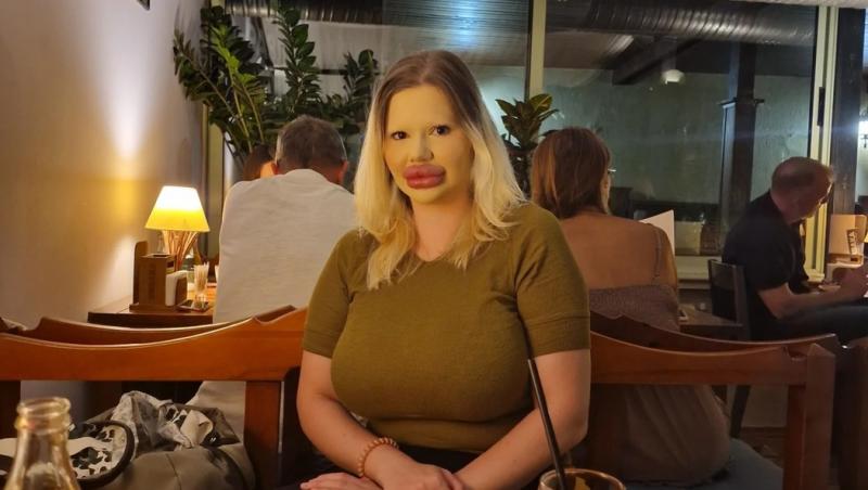 Andrea Ivanova, femeia cu cele mai mari buze din lume, a trezit noi controverse în mediul online după ce s-a filmat luând cina