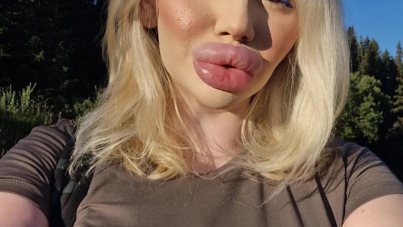 Andrea Ivanova, femeia cu cele mai mari buze din lume, a trezit noi controverse în mediul online după ce s-a filmat luând cina