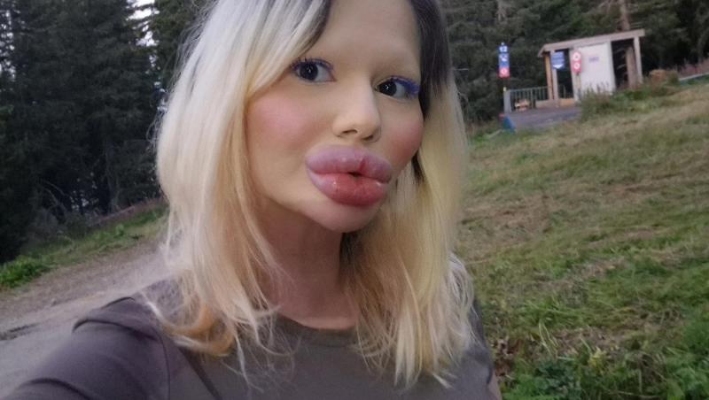 Andrea Ivanova, femeia cu cele mai mari buze din lume, a trezit noi controverse în mediul online după ce s-a filmat luând cina