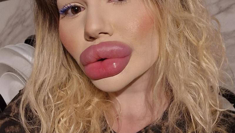 Andrea Ivanova, femeia cu cele mai mari buze din lume, a trezit noi controverse în mediul online după ce s-a filmat luând cina