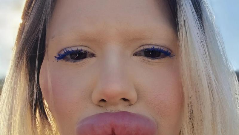 Andrea Ivanova, femeia cu cele mai mari buze din lume, a trezit noi controverse în mediul online după ce s-a filmat luând cina