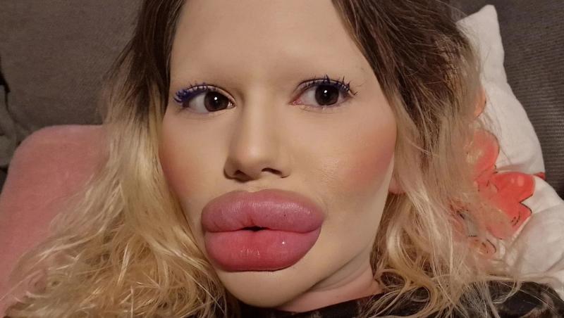 Andrea Ivanova, femeia cu cele mai mari buze din lume, a trezit noi controverse în mediul online după ce s-a filmat luând cina