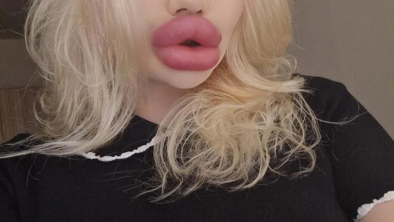 Andrea Ivanova, femeia cu cele mai mari buze din lume, a trezit noi controverse în mediul online după ce s-a filmat luând cina