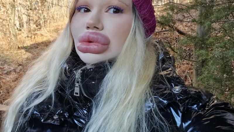 Andrea Ivanova, femeia cu cele mai mari buze din lume, a trezit noi controverse în mediul online după ce s-a filmat luând cina