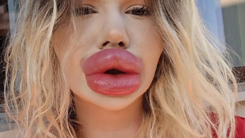 Andrea Ivanova, femeia cu cele mai mari buze din lume, a trezit noi controverse în mediul online după ce s-a filmat luând cina