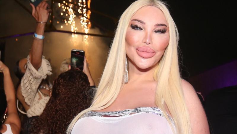 Jessica Alves, de nerecunoscut după ce a apelat a șasea oară la lifting facial. În ce ipostază a fost văzut fostul bărbat Ken