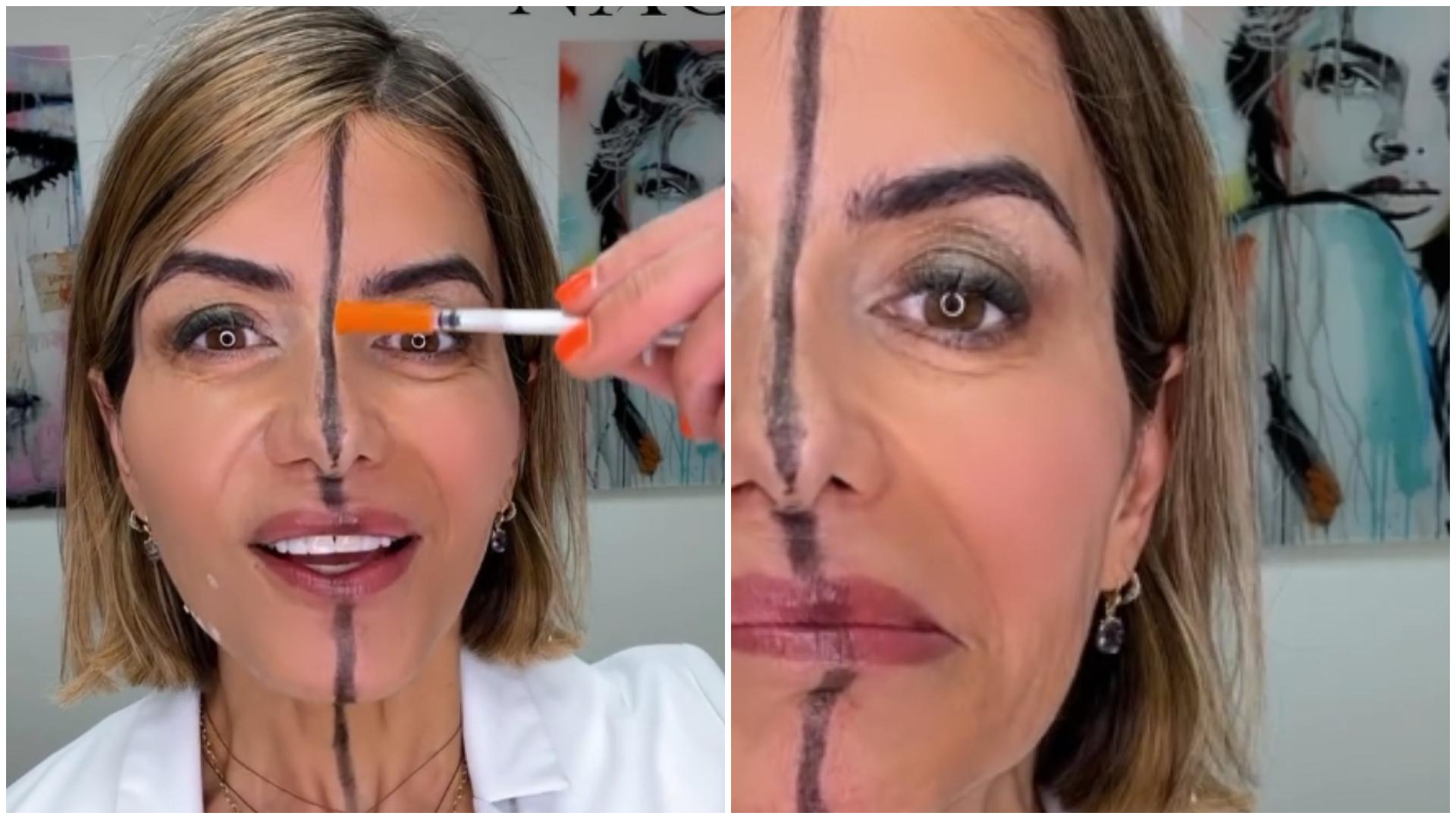 Un medic estetician care și-a injectat doar jumătate de față cu botox