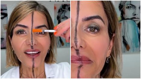 Un medic estetician și-a injectat doar jumătate de față cu botox, iar rezultatele au fost clar vizibile. Diferența a fost uriașă